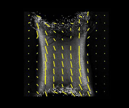 450w_Collagen-Alignment